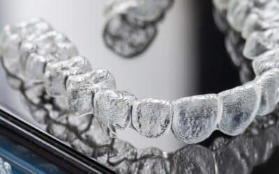 Invisalign Braces: The Healthy Way To Straighten Teeth In Garland, TX