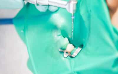 Garland, TX Dentist Assures Patients Of The Safety Of Root Canal Dental Treatment