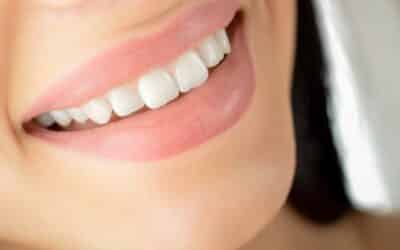 Before, During, And After Six Month Smile Treatment In Garland, TX